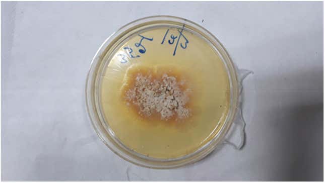 The man’s fungal infection grown in a petri dish.