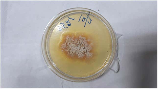 La infección fúngica del hombre creció en una placa de Petri.