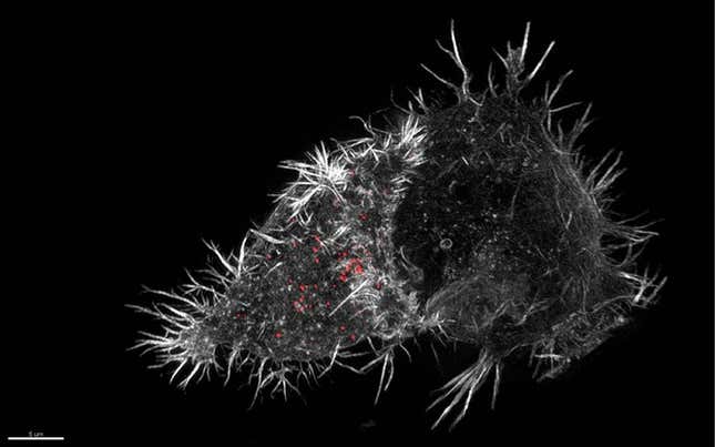 Natural killer (NK) cell immune synapse, 3D-SIM.