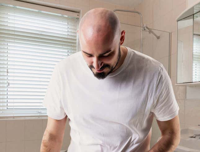 Image for article titled Bald Man’s Pubes Still Going Strong