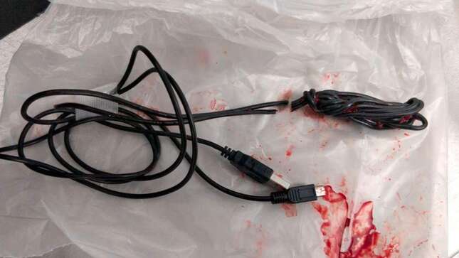 Imagen para el artículo titulado Un joven termina en urgencias después de intentar medir el interior de su pene con un cable USB