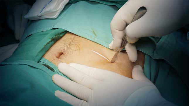 Image for article titled Common Medical Procedures And What They Cost Around The World