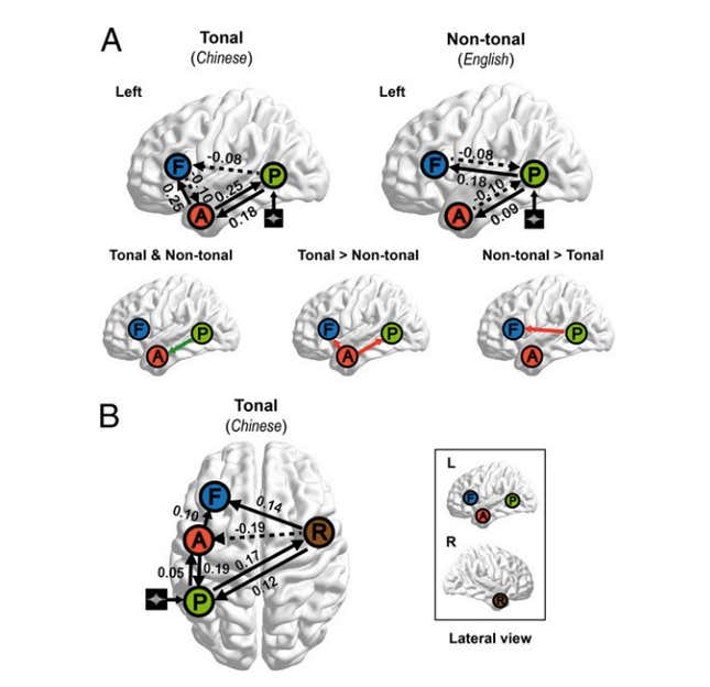 Image for article titled Chinese speakers use more of their brain than English speakers