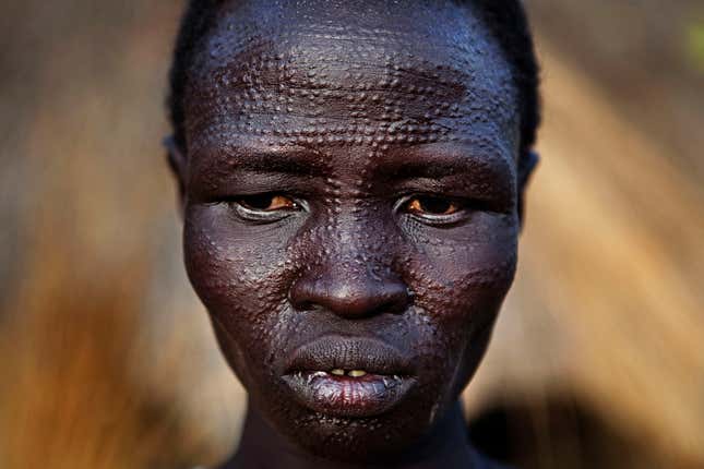 A Sudanese woman with ethnic Nuer tribal scarification in the town of Malakal in Upper Nile state, April 10, 2010. The Nuer receive facial markings during initiation into adulthood.