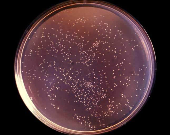 Yersinia pestis grown on a petri dish.