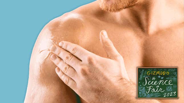 A male birth control gel applied to the shoulder appears safe and effective in clinical trials. 