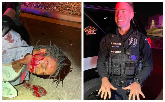 Image for article titled Cop Smiles after Violently Beating Homeless Army Vet