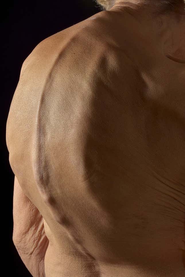 curved spine