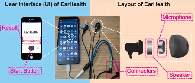 Imagen para el artículo titulado Desarrollan unos auriculares experimentales capaces de detectar infecciones de oído, tapones y otras dolencias