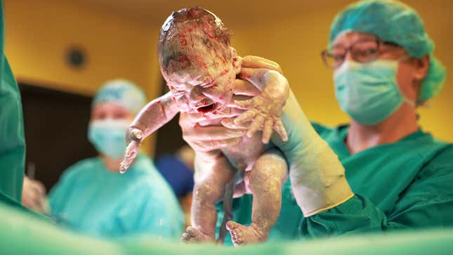 Image for article titled Shocking Things No One Told You About Childbirth