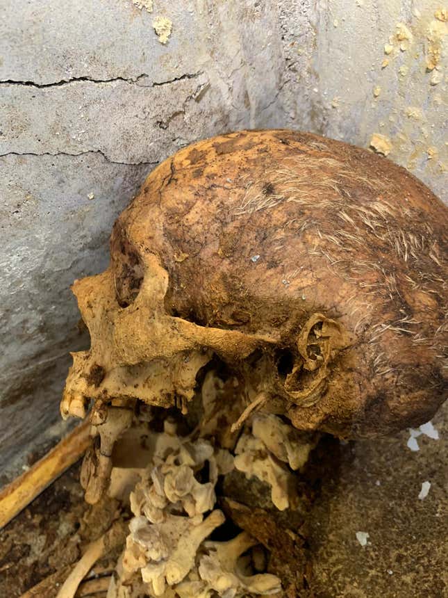 The skull, with patches of gray hair and portions of a left ear still visible.