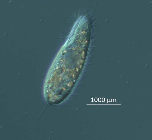 Fahndungsfoto: Die mikroskopisch kleine Ciliatenart, von der angenommen wird, dass sie hinter dem Absterben im Jahr 2022 steckt.