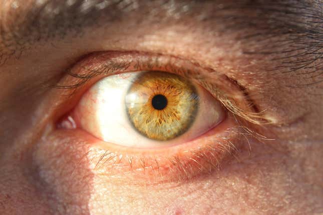 Imagen para el artículo titulado Este hombre no ha podido cerrar los ojos durante tres años por culpa de una cirugía plástica fallida
