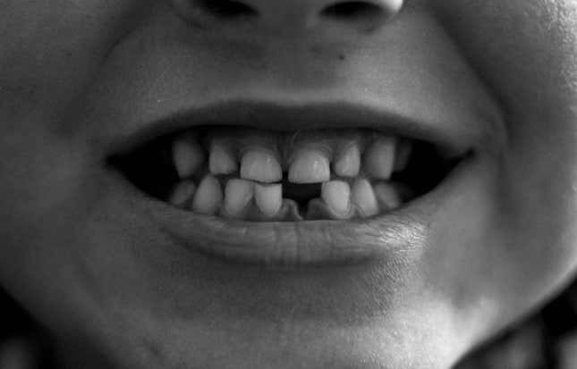 Imagen para el artículo titulado Un anticuerpo podría ser la clave para regenerar los dientes perdidos
