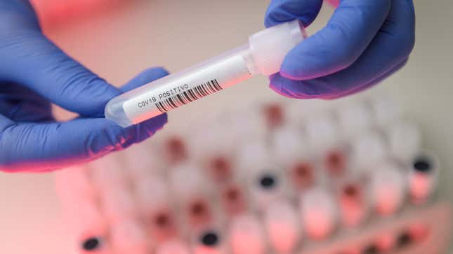 Un trabajador de laboratorio manejando una muestra positiva de covid-19 en el Laboratorio Hermes Pardini en Brasil