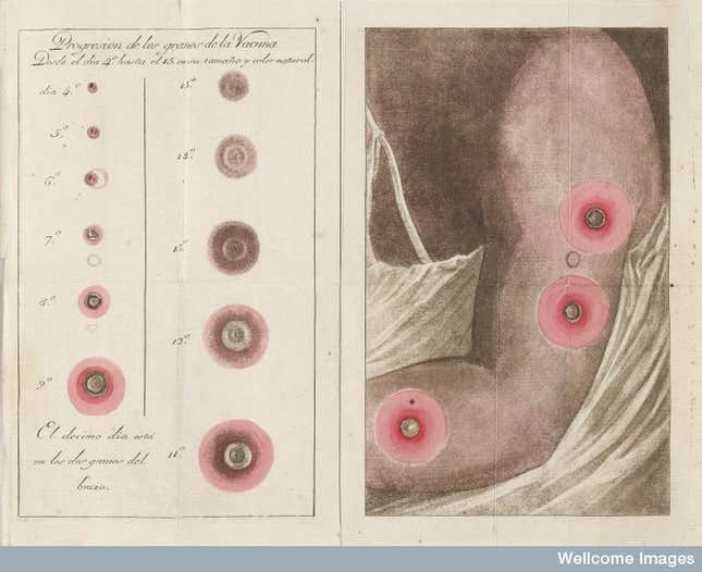 Image for article titled 'Nothing Short of Attempted Murder': A Brief History of Anti-Vaxxers