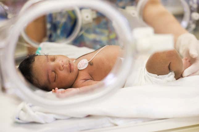 Black baby in incubator