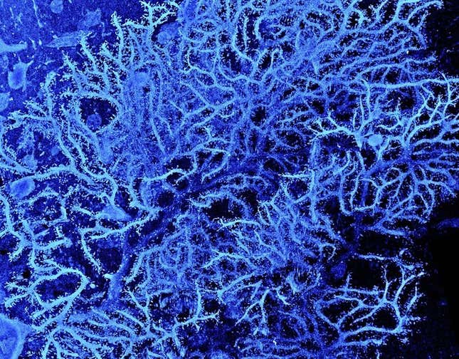 purkinje cell