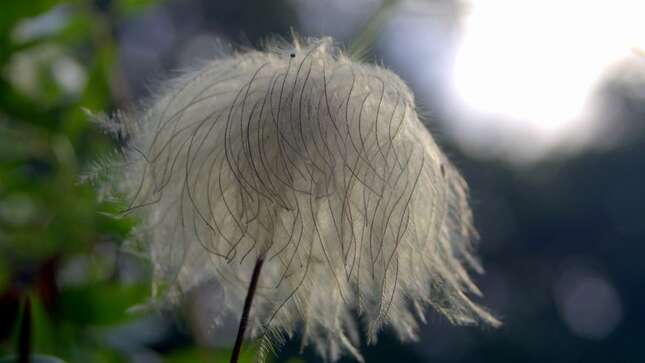 Este niño es una de las 100 personas en el mundo con un pelo que no se puede peinar