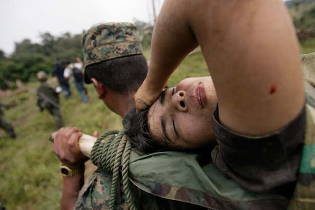 An FARC fighter injured during an army attack on her camp.