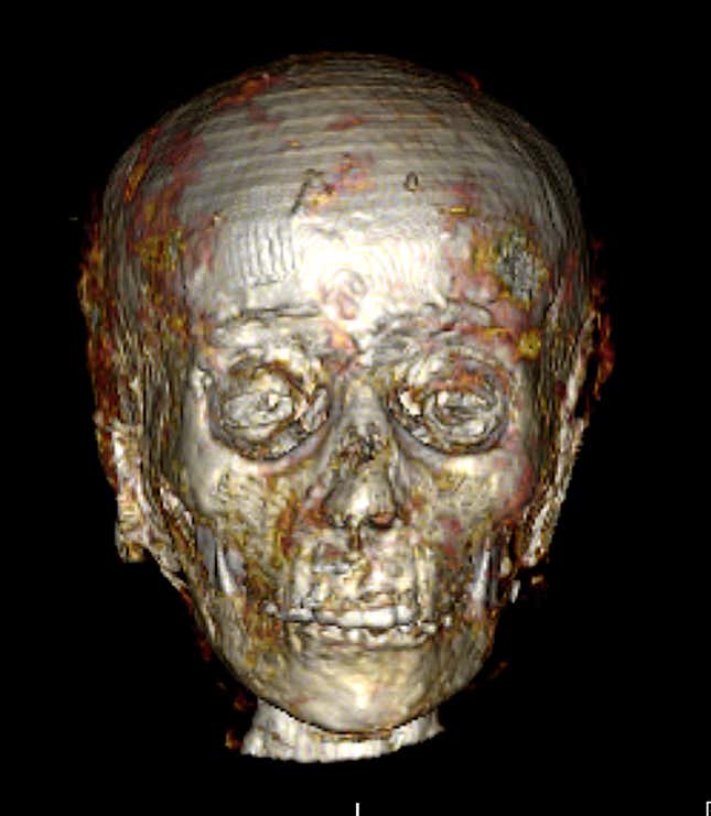 Image for article titled New Scans Reveal 2,300-Year-Old Mummy Boy and His Gold Treasures