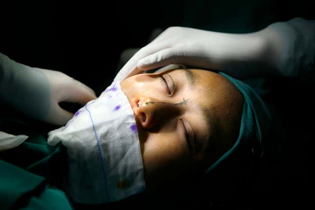 Image for article titled This is what it’s like to wake up during surgery