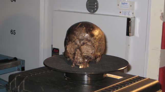 The skull within which the brain was found.