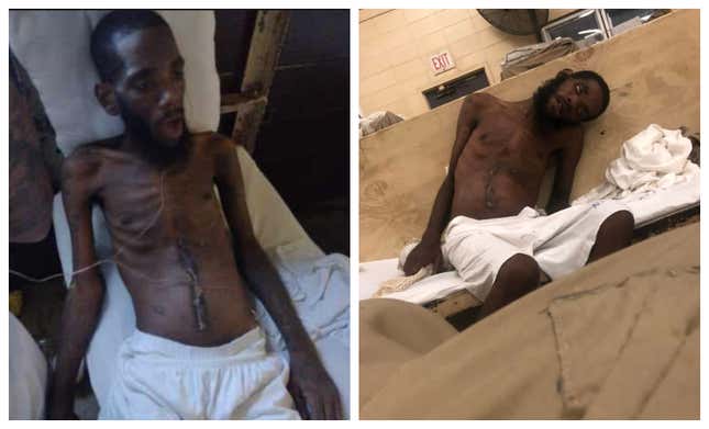 “My brother’s health is rapidly declining. As you can see in these photos he is extremely malnourished. In these particular photos he cannot walk nor stand he is weak and vulnerable. My last visitation with my brother was July 24, 2022 he was in good condition. I am not a doctor but his health seems to be deteriorating. I received 2 pictures of him today saying ‘GET HELP,’” read Vaughan’s Facebook post.