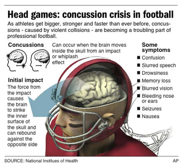 Graphic describes what happens to the brain of a football player to cause a concussion.