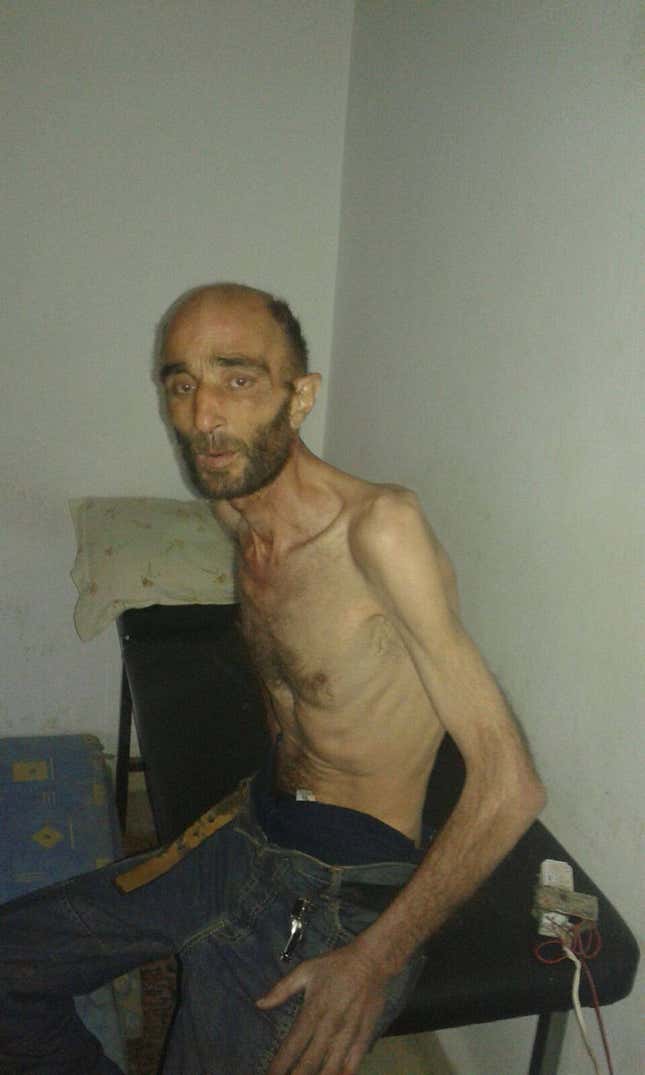 Image for article titled Horrifying images of starving Syrians are bringing Assad’s atrocities back into focus
