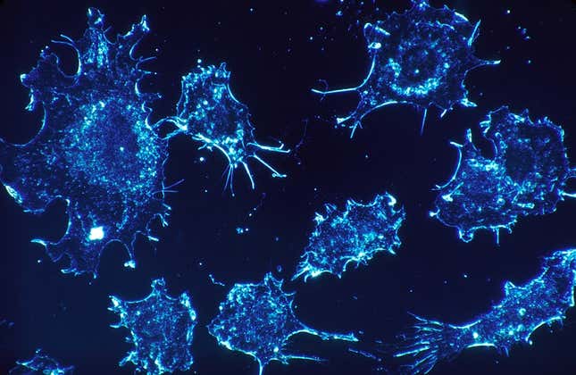 Imagen para el artículo titulado Una nueva terapia contra el cáncer logra una remisión del 100% en todos los pacientes