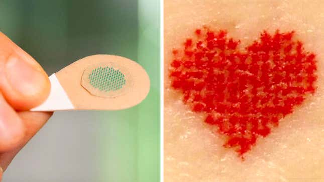 A microneedle patch loaded with green tattoo ink, and a heart-shaped red tattoo created by the new process.