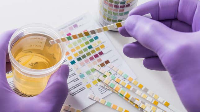 lab technician drug testing a urine sample