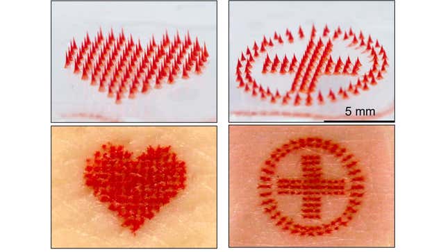 Imagen para el artículo titulado Los tatuajes indoloros podrían ser una realidad gracias a estas agujas microscópicas llenas de tinta