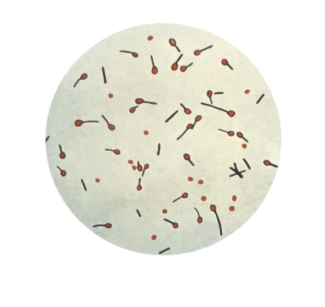 A photomicrographic view of Clostridium tetani, the bacteria that causes tetanus.