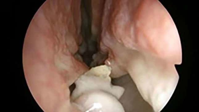 Imagen para el artículo titulado Escrotos insólitos o erecciones de 9 días: los casos que entraron a forma parte de la literatura médica en 2019