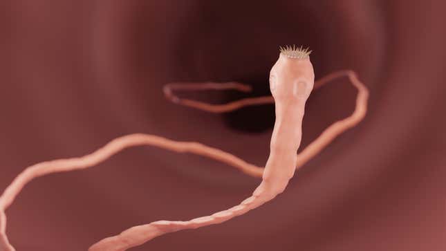 Image for article titled 14 of the Worst Human Parasites That Exist (and How to Avoid Them)