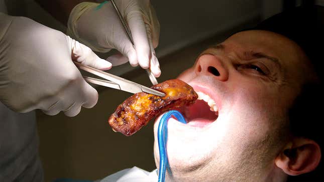 Image for article titled Breakthrough Procedure Allows Surgeons To Transplant Pig Rib Directly Into Human Mouth