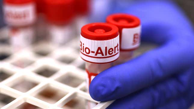 A swab specimen containing monkeypox virus is labeled ‘Bio Alert’ at the UW Medicine Virology Laboratory on July 12, 2022 in Seattle, Washington. 