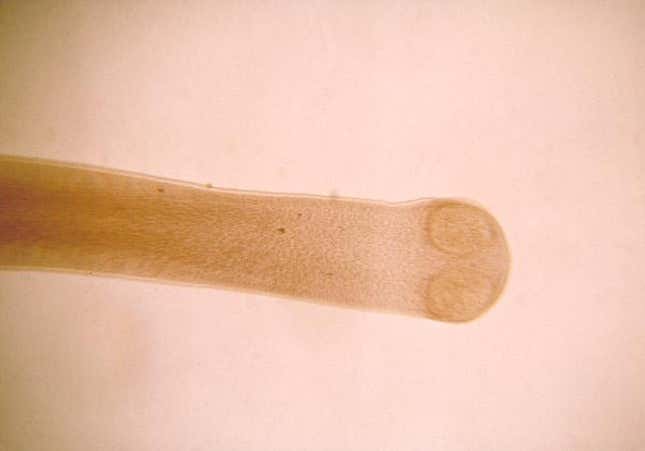Hymenolepis diminuta.
