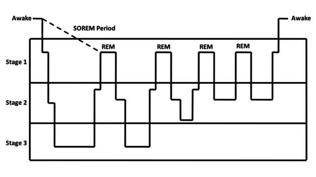 Cycles of sleep.
