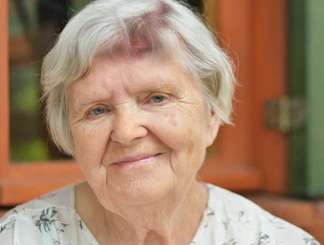Image for article titled Party Hat Leaves Circular Bruise On Grandma