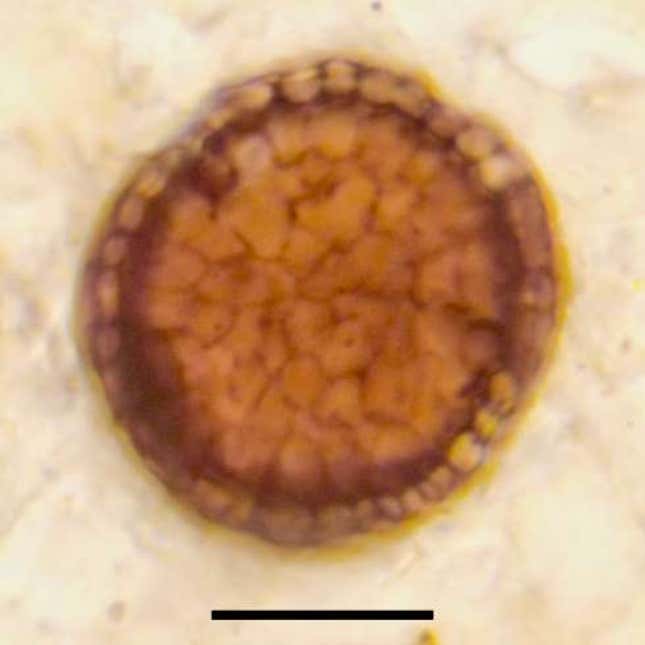 La diferencia en los tipos de células es visible al microscopio.