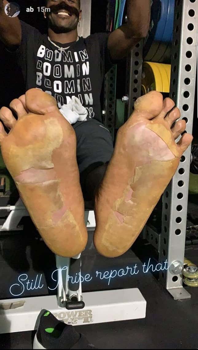 Image for article titled Antonio Brown's Feet Are A Nightmare