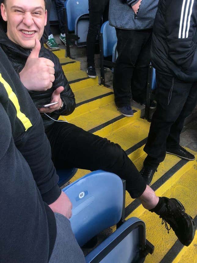 Image for article titled Leeds Fan Breaks Ankle While Celebrating A Goal, Waits Until After The Game To Go To Hospital