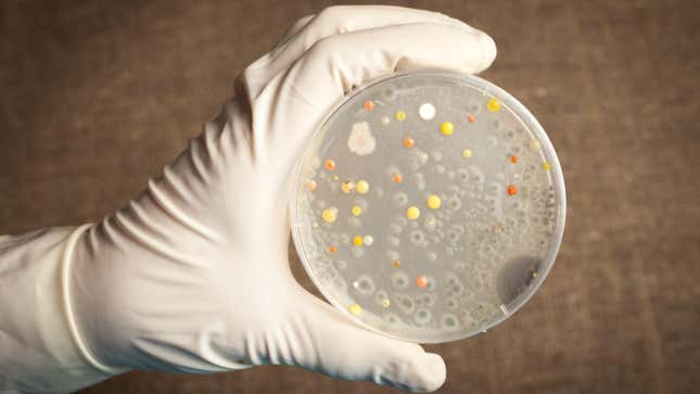 Anthrax bacteria growing on a petri dish.