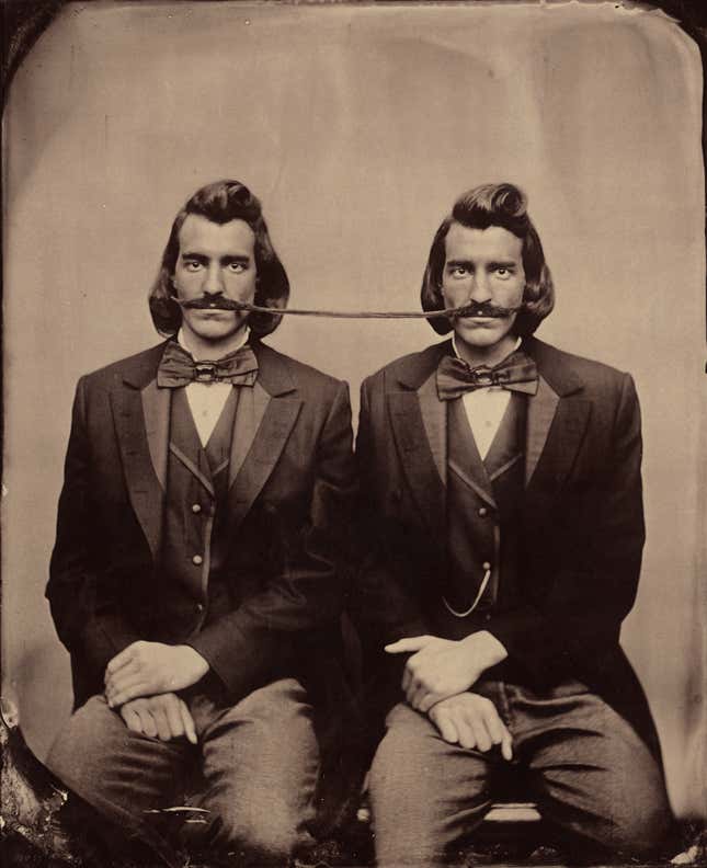 “Conjoined Twins,” an albumen print from a wetplate collodion negative.