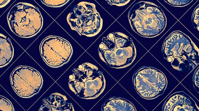 Imagen para el artículo titulado Esta vacuna experimental contra el cáncer hace que las células cancerígenas traicionen a sus semejantes