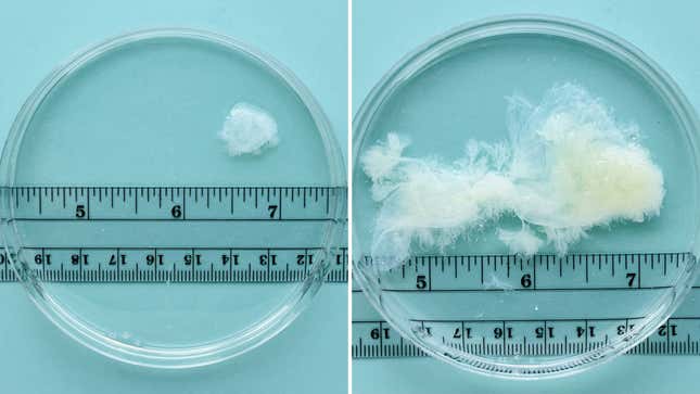 Side by side photos of petri dishes containing pregnancy tissue from abortions done at six and nine weeks of pregnancy.