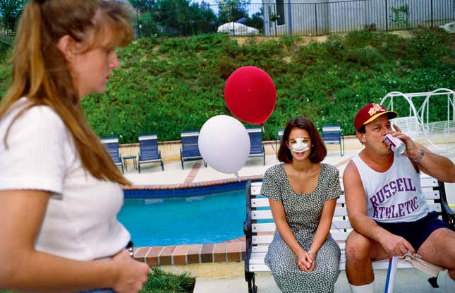 1993: Lindsey, 18, at a Fourth of July party three days after her nose job, in Calabasas, California. Five of her close friends at Calabasas High School had already had plastic surgery.